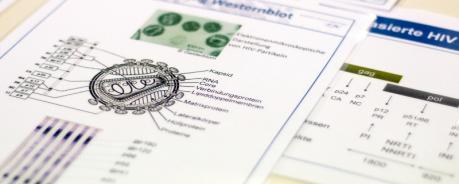 Papier, auf dem die Struktur des HI-Virus abgebildet ist