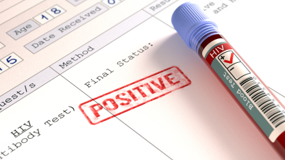Fortbildung - HIV-Infektion und Therapie 2024